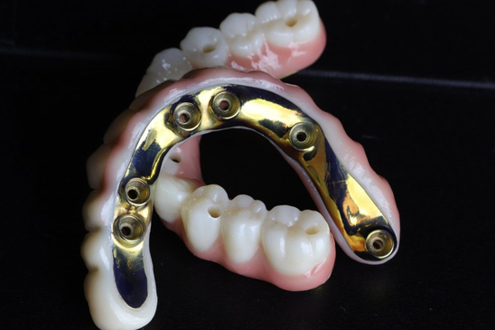 Slider image (4) All On X Dental Studio: Leading Dental Clinic in Los Algodones